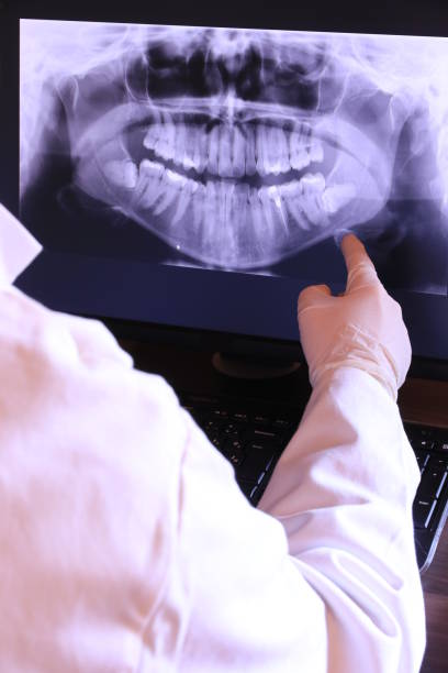 Best Dental Abscess Treatment in Hacienda Heights, CA